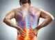 7 вправ, які допоможуть подолати біль у спині